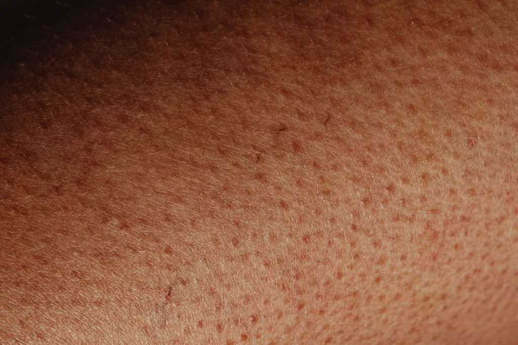 Por Que o Corpo Arrepia com Frio ou Medo? A Ciência Explica