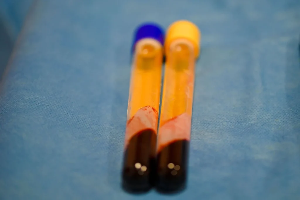 Por que o sangue é amarelo: a química do plasma explicada
